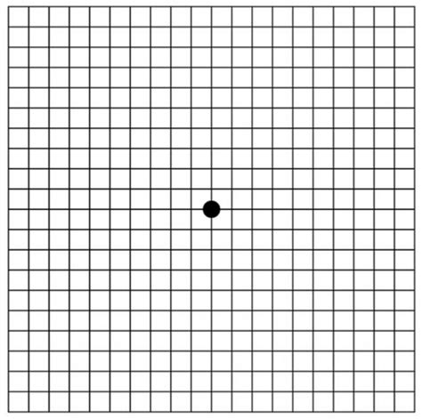 blind spot test normal results|Amsler Grid Visual Field Test: Uses, Procedure, Results.